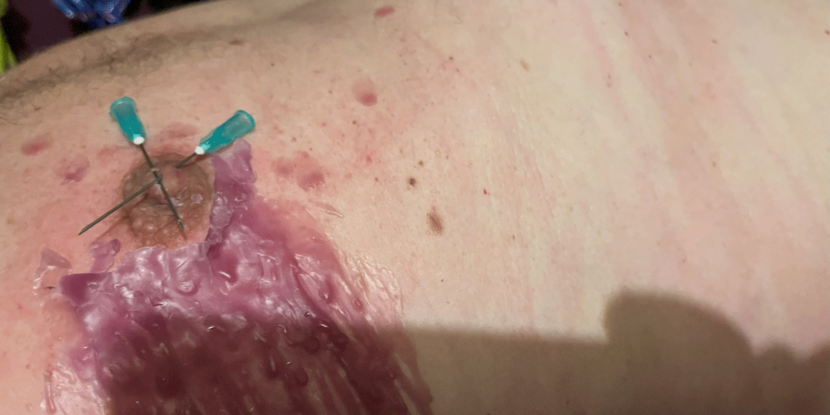 Pijnlijke minuten in de bek van een "DHZ-krokodil"